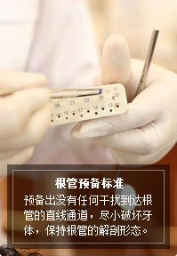 根管預備標準